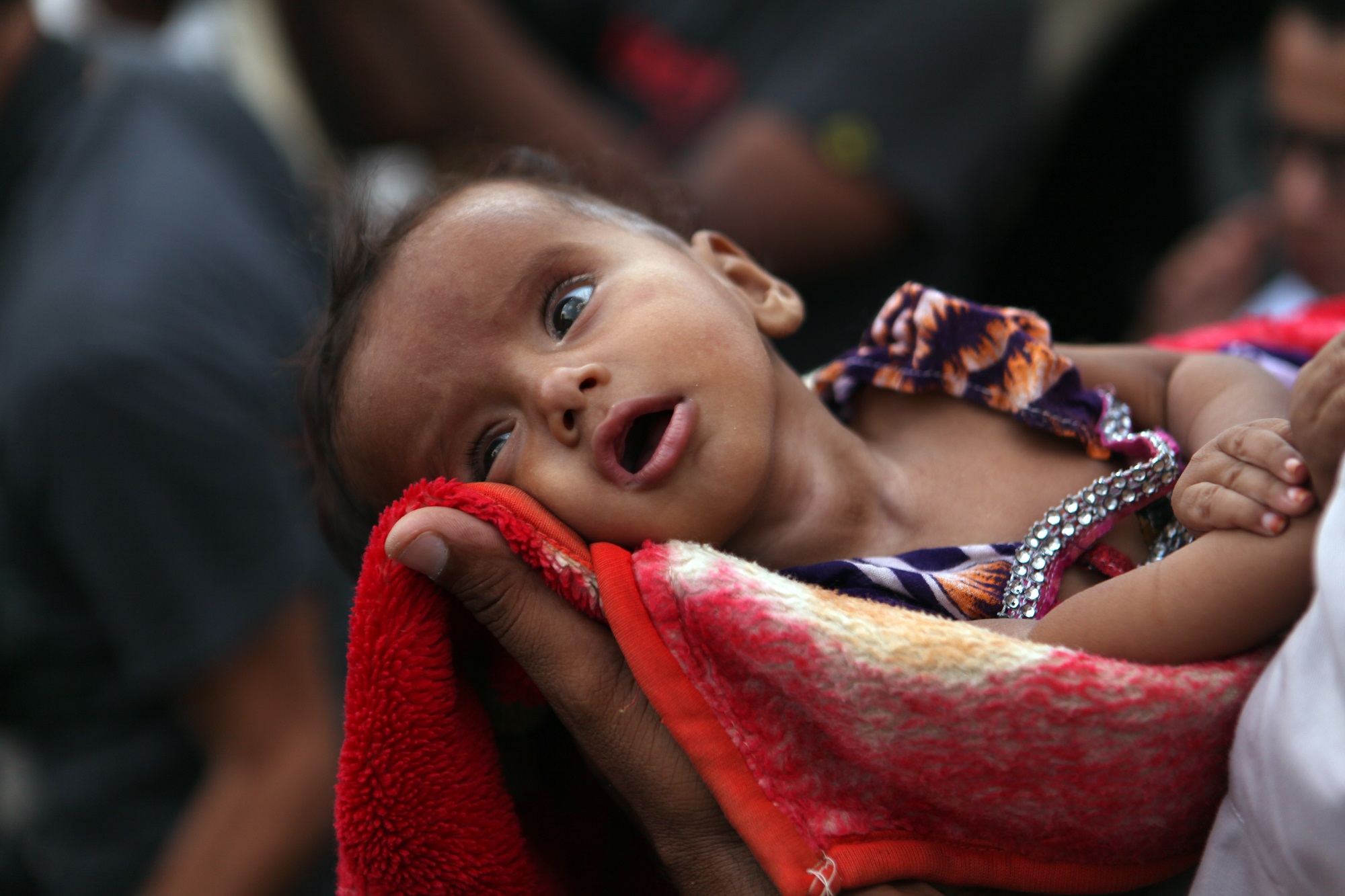 Unremitting efforts by Qatar Charity to curb malnutrition
